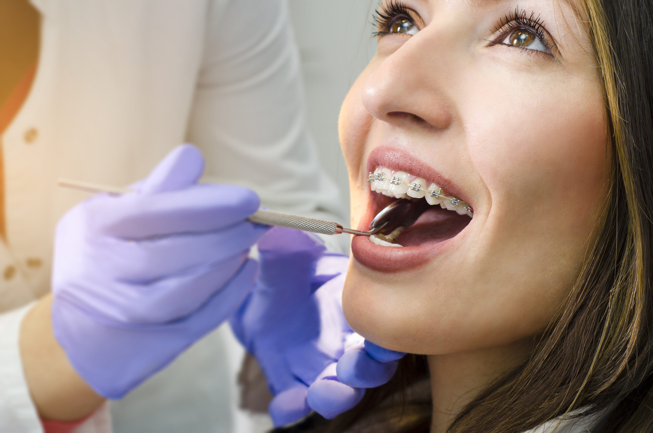 Ortodontie Adulti • Tratament Ortodontic Adulti • The Smile Space